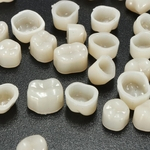 Instrumentos de Coroa Temporária Dentária Anterior Para Dentes de Porcelana Posterior