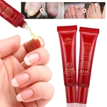 Ficha técnica e caractérísticas do produto Prego ervas tratamento onicomicose Paroniquia Antifungal de creme à base de plantas chineses Toe Nail fungo tratamento Creme